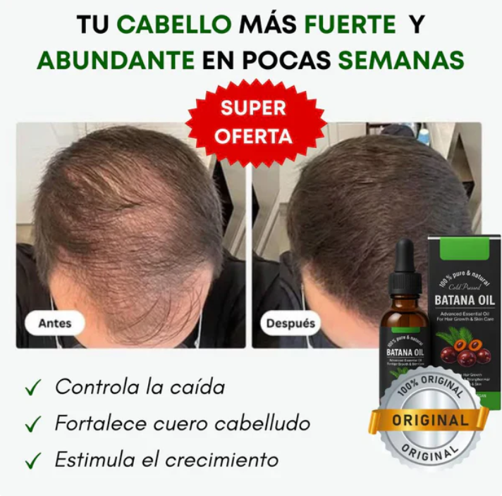 Aceite de Batana 100% Natural - Recupera tu Cabello Desde la Raíz
