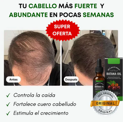 Aceite de Batana 100% Natural - Recupera tu Cabello Desde la Raíz